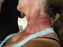 Jodi Byrne Special FX Makeup Artist Neck bruising